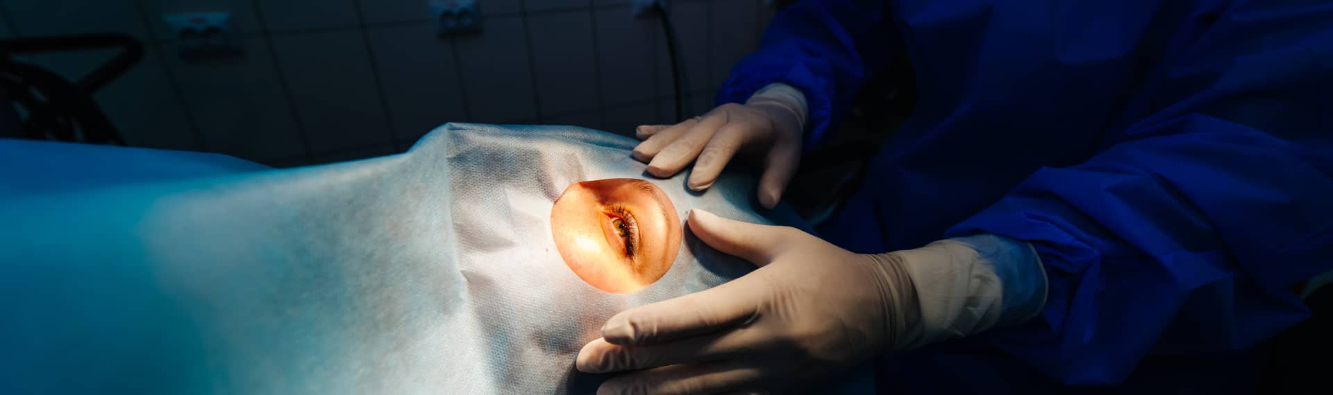 Chirurgie de correction palpébrale